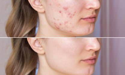 Услуги - Medgel